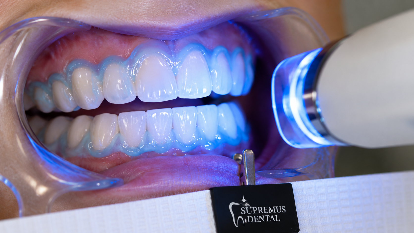 Blanqueamiento dental