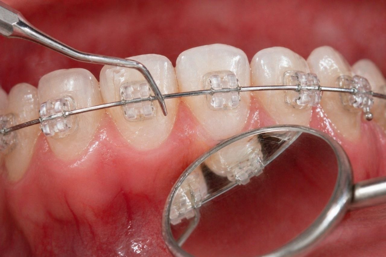 Imagen informativa de guía dental 3