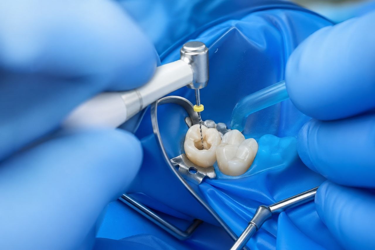 Imagen de tratamiento dental 3